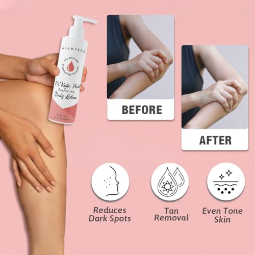Image of Glamveda Body Lotion with 2% Kojic Acid & Alpha Arbutin 200ml Pack of 3 | 24hr Deep Moisturizer, Nourishes & Protect Skin | Remove Dark Spots, Pigmentation, Tan Removal | Non Greasy | All Skin Type