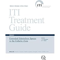 Extended Edentulous Spaces in the Esthetic Zone