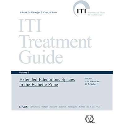 Extended Edentulous Spaces in the Esthetic Zone