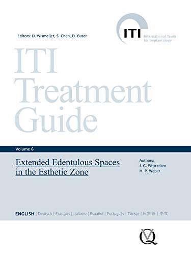 Extended Edentulous Spaces in the Esthetic Zone (ITI Treatment Guide Series Book 6)