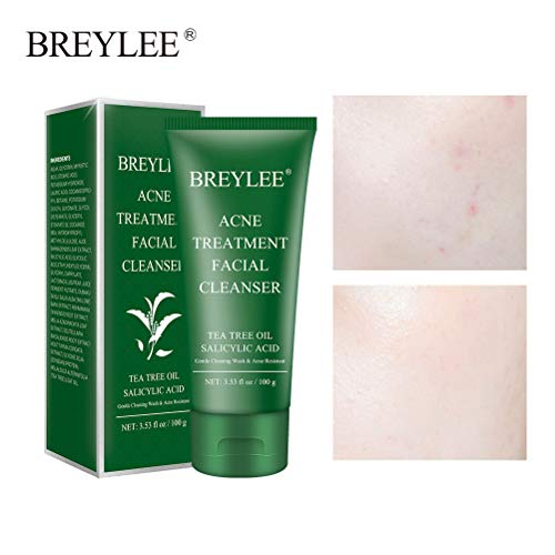 Preisvergleich Produktbild Gesichtsreiniger, Gesichtsreinigungscreme, Teebaumöl und Salicylsäure Essenz, Hautpflegemittel, Poren schrumpfen / Öl kontrollieren / Mitesser / Gesichtswaschcreme entfernen