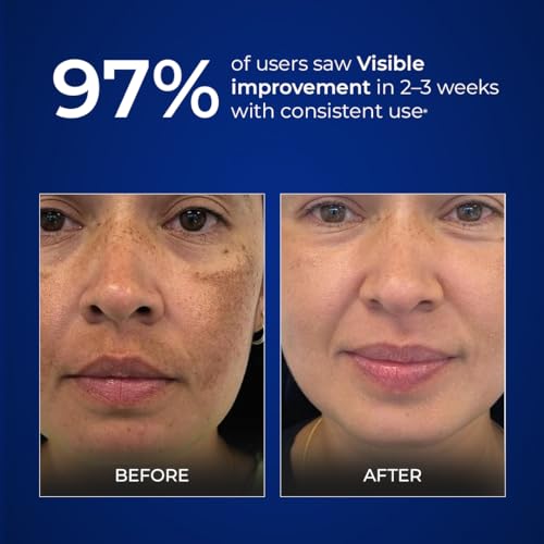 Image of Aqueria Brightening & Moisturizing Multi-Active French Sunscreen SPF 50 PA++++ | In-Vivo /In-Vitro Tested | Travel Pack | 5% Niacinamide, 5 Ceramides & Vitamin E | Modern UV Filters | Broad Spectrum UVA /UVB & Blue Light Protection | Lightweight, No White Cast, Sweat Resistant | Suitable for Daily Use | For Normal, Dry & Sensitive Skin | Pack of 5 (75G)