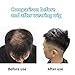 WeKen Short Toupee for Men - Hair Topper Wig Clip in Crown Extensions - Mens Piece for Covering White Loss - Daily Wear