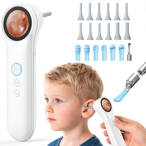 Ear Camera with 1.21 Screen 1080P HD Digital Otoscope Ear Scope with 4 LED Lights Ear Cleaner Camera with 10 Ear & Nose Tips 6 Ear Pick Tools Skin Probe Type-C Charging for Adults Kids Pets