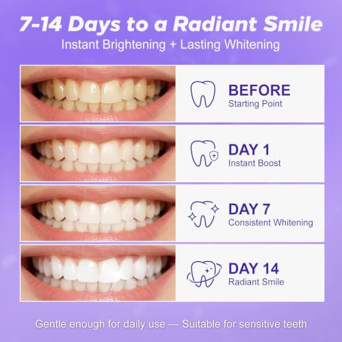 Image of Purple Teeth Whitening Strips - 28 Teeth Whitener Strips (14 Uses) | Purple Color-Correcting Gel Technology | Teeth Whitening Kit for Sensitive Teeth | Enamel Safe, Peroxide-Free for a Brighter Smile