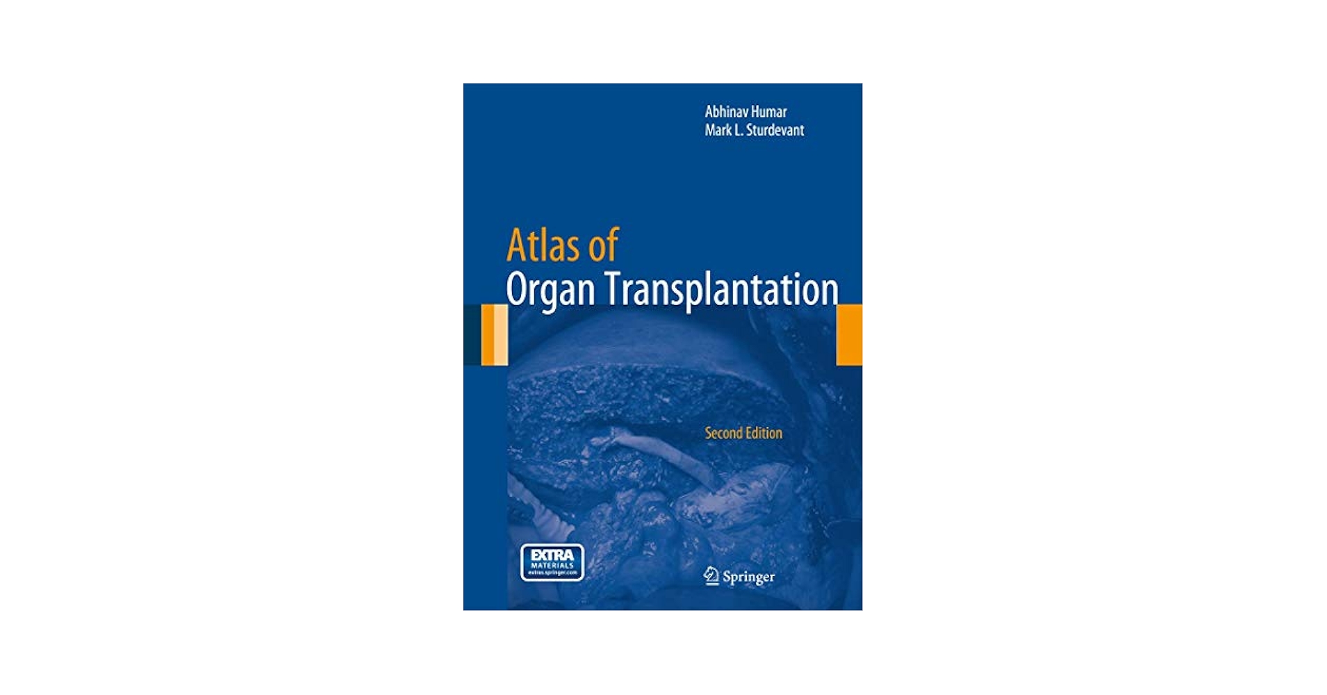 Atlas of Organ Transplantation (DVDなし） Atlas of Organ Transplantation: 9781447147749: Medicine