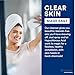 SkinSmart Antimicrobial Facial Cleanser for Breakouts & Blemishes; Hypochlorous Acid Formula Targets Bacteria to Reduce Skin Irritation and Flush Pores Clean, 8 oz Spray, All Ages & All Skin Types
