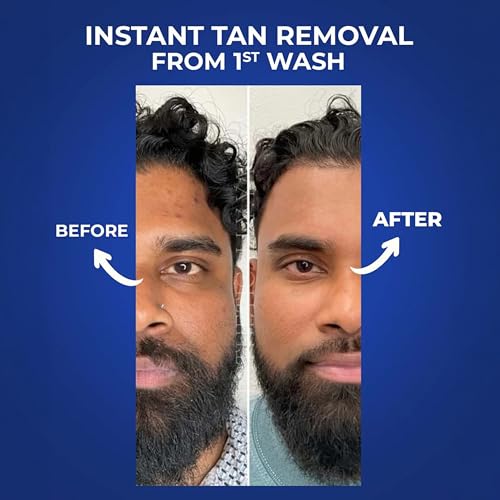 Image of Aqueria 10% Instant De-Tan Enzyme Peel Shot for gentle Exfoliation with Niacinamide, Rice Water & Lactic Acid | Instant Tan Removal & Dead Skin Removal Exfoliating Gel | Brightens Skin, Removes Build-Up & Reveals Instant Glow | For Dark Neck, Knees, Elbows & Sun Tan | Suitable for All Skin Types | 100ml