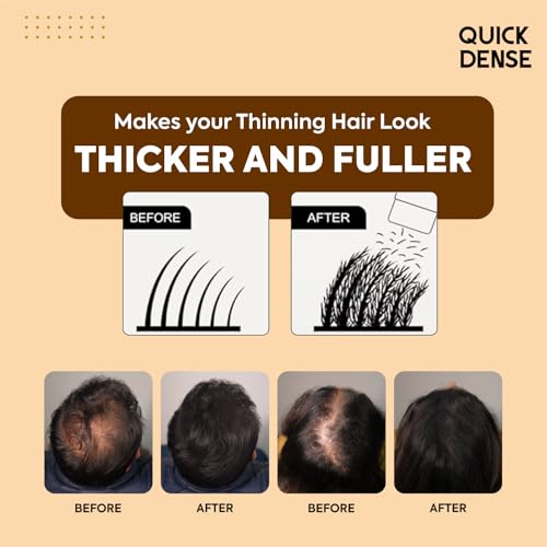 Image of Hair Building Fiber Refill Pack | Plant Based Cotton Fibers Refill Bag for Men & Women | Styling Accessory for Thin Hair Appearance | Natural Look - Black (Pack of 5)