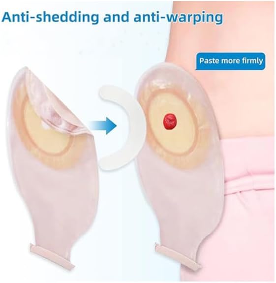Miniatura 5 de 20 unidades de suministros de ostomía para la piel, tiras impermeables para fugas, cinta adhesiva para la piel para bolsas de estoma de colostomía