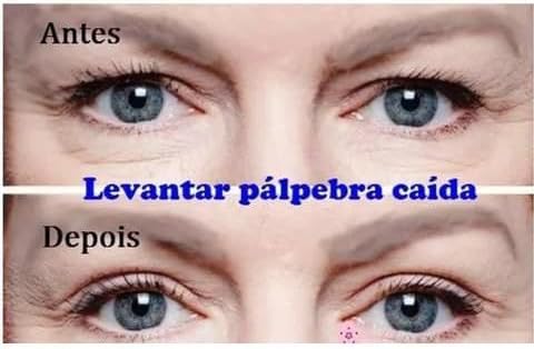 Adesivos Fita Transparente Levanta Pálpebras Caídas 600 Unidades Ultra Invisível Pálpebras Firmes Ad