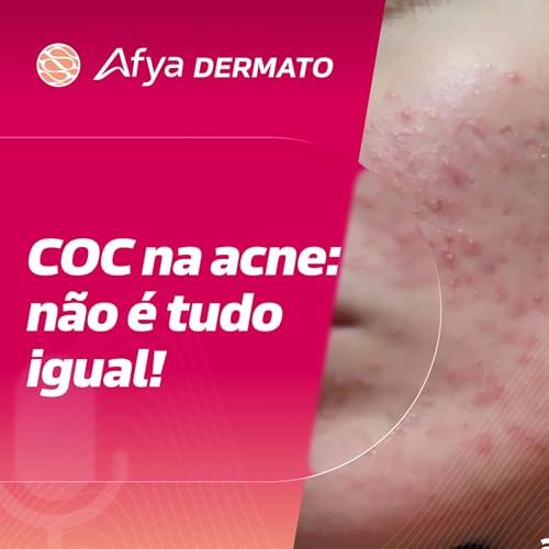 COCs: todos funcionam igual? O que a nova revis&atilde;o revela