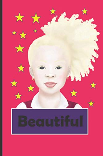 Beautiful: Albino Little Girl Thoughts Book