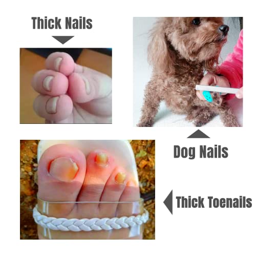 Idou 2 Pieces Toe Nail Files For Thick Nails,Stainless Steel, 4 Sides For Men Seniors & Dogs #TOP3
