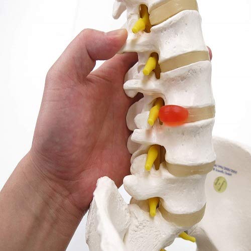 脊椎模型 骨盤付き 3B Scientific GmbH 脊椎模型 骨盤付き 3B Scientific GmbH