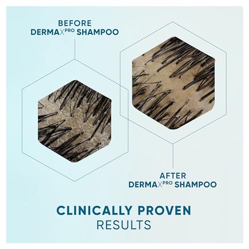 Head & Shoulders DermaXPro Anti-Dandruff Shampoo 300ml - Image 4