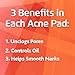 OXY Maximum Action 3-in-1 Acne Medication Treatment Pads, 90 CT