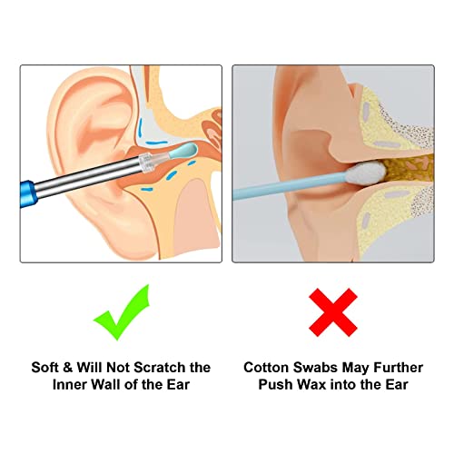 Bebird Original R3 & New R1 Ear Wax Removal Replacement Accessories Set, Ear Spoons Earpick Compatible With T15/X3/D3 Pro - 9 Pieces #TOP4