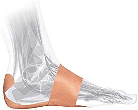 FasciaDerm System for Plantar Fasciitis