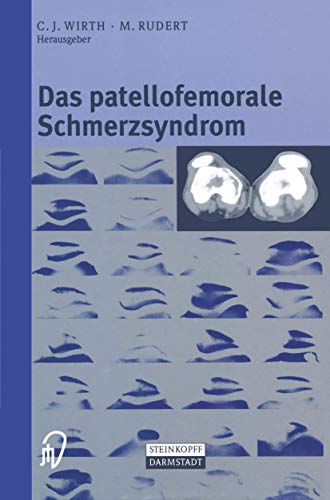 Preisvergleich Produktbild Das patellofemorale Schmerzsyndrom