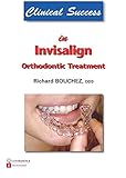 Clinical Success in Invisalign Orthodontic Treatment (English Edition) Clinical Success in Invisalign Orthodontic Treatment (English Edition)
