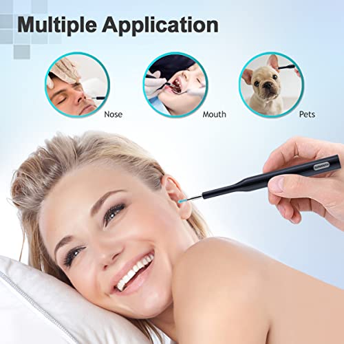 Sunanth Ear Wax Removal Tool With 1080P Ear Camera,Ear Cleaner Earwax Removal Kit With 6 Led Lights,Wireless Ear Wax Remover With 6Pcs Ear Cleaning Kit Compatible With Iphone,Ipad And Android Phones #TOP4
