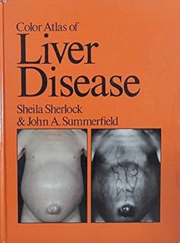 Hardcover Color atlas of liver disease Book