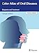 Produktbild Color Atlas of Oral Diseases: Diagnosis and Treatment