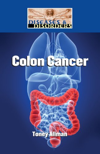 Colon Cancer (Diseases and Disorders)