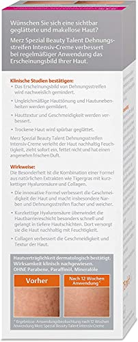 Merz Spezial Dehnungsstreifen Intensiv-Creme zur Hautpflege