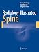 Radiology Illustrated: Spine