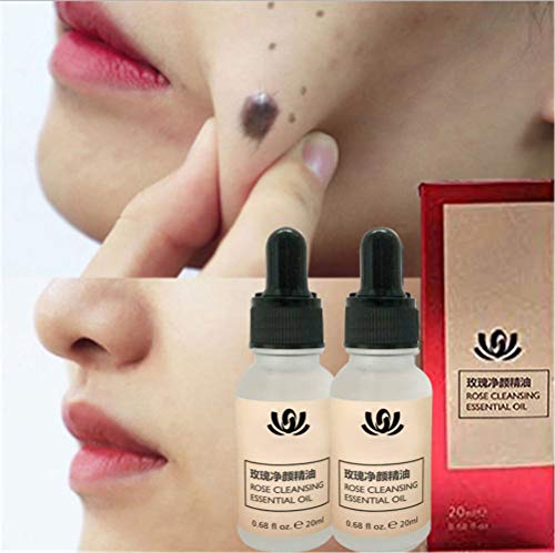 Organic Tags Solutions Serum, Instant Skin Tag Remover, Mole Remover Cream, Dark Spot Corrector Brightening Serum, Repair Cream Oil Fix Black Spot (2PCS)