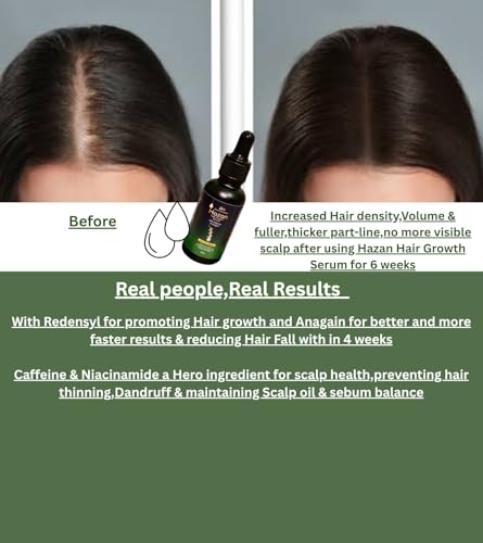Image of Hazan Hair Growth Serum With 4-in-1 Advanced Formulation-Redensyl + Anagain + Niacinamide + Caffeine | Boosts Hair Growth & Density | Prevents Hair Fall by 90%,tested on Real individuals | Prevents Rough,Frizzy Hairs,Restores Smoothness | Non-Greasy | For Men & Women | 30ml