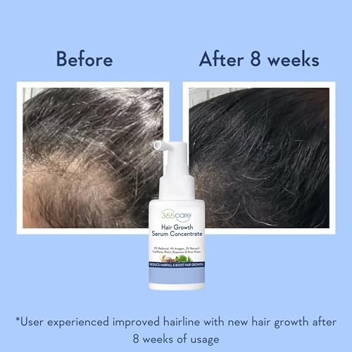 Image of Professional Hair Growth Serum - Strengthens Hair Follicles, Reduces Breakage & Hair Fall - Peptides & Pro-Vitamin B5 - 50ml