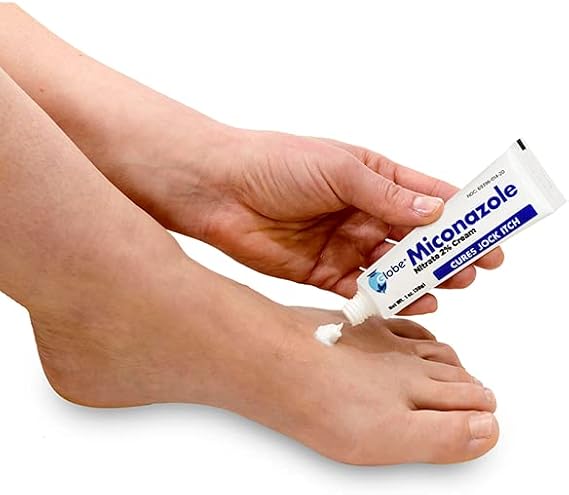Globe Miconazole Nitrate 2% Antifungal Cream 1 oz, Cures Most Athletes Foot, Jock Itch, Ringworm and More. Compare to the Leading Name Brand