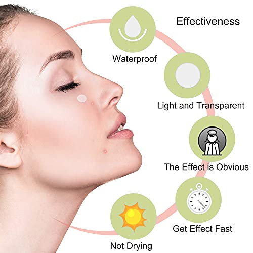 Rpanle Cerotti per Acne, 180 Pezzi Cerotti per