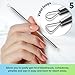 Ultimate Blackhead Removal Skincare Tools Set, Vidal loops, Uno spoon, 5 in 1, metal storage case