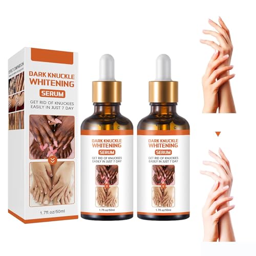Grgowe 2Pcs Siero Sbiancante Per La Pelle Per Corpo,Nocche Scure Siero Sbiancante,Siero Schiarente Corpo Scuro Crema,Contro Macchie Scure,Siero Di Correzione Della Per Ascelle,Ginocchia,Gomiti