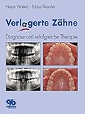 Verlagerte Zähne: Diagnose und erfolgreiche Therapie
