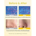 Elvira Pore Control Cleansing Oil, Makeup Remover for Sensitive, Oil Cleanser for Face, Blackhead Removal, Korean Skin care, Hydrating, Fragrance-Free - Image 2