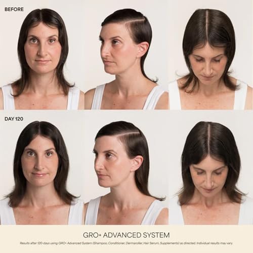 VEGAMOUR GRO+ Advanced Hair Serum for Density & Scalp Health 1oz — view 3