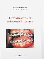 Optimization of orthodontic elastics B0006RLQNW Book Cover