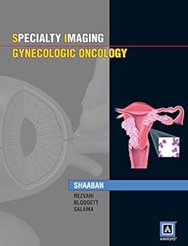 Hardcover Specialty Imaging: Gynecologic Oncology Book