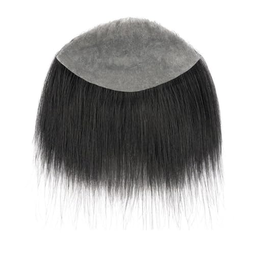 Complément capillaire homme calvitie pour retrouver une ligne de cheveux naturelle