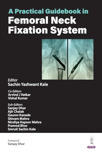 A Practical Guidebook in Femoral Neck Fixation System (English Edition)