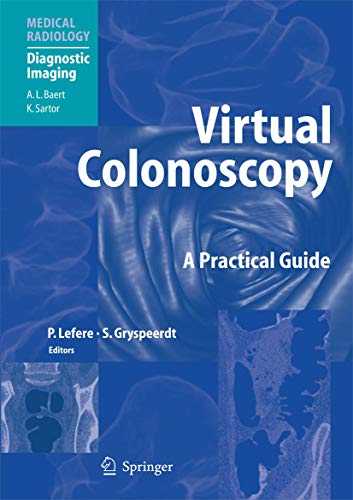 Virtual Colonoscopy: A Practical Guide view 2