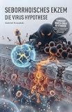 Seborrhoisches Ekzem: Die Virus Hypothese