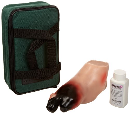HEALTH EDCO W43107A Biolike Severe Diabetic Foot Model