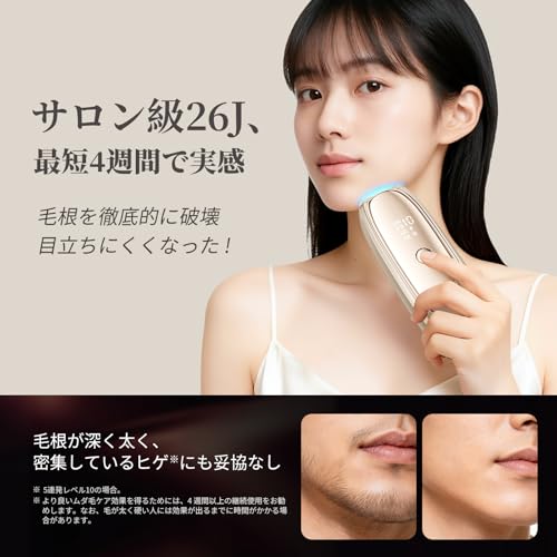 Amazon.co.jp: ANLAN: 脱毛器Zap
