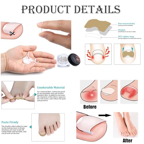 Image of 101 /102pcs Ingrown Toe Nail Remover, Toenail Corrector Strips and Ingrown Toenail Correction Tool, for Daily Nail Care and Post-Exercise Maintenance (101 PCS Brown)
